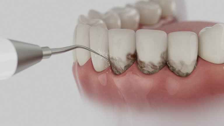 Trusted Dental Crowns And Bridges service in Onancock, VA - Dentist Open Now